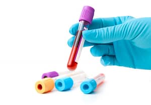 picture of hand holding blood for fertility tests, infertility testing
