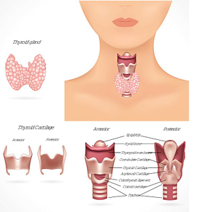 picture of a woman's neck who has hypothyroidism showing her thyroid gland and where the thyroid is located
