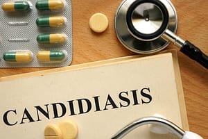 picture of treatment for Candida yeast candidiasis