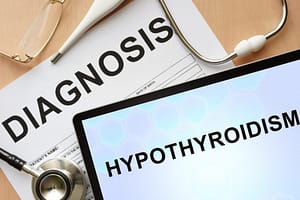 diagnosis of hypothyroid or underactive thyroid or Hashimoto's