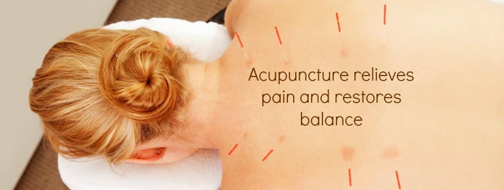 acupuncture relieves pain and restores balance picture